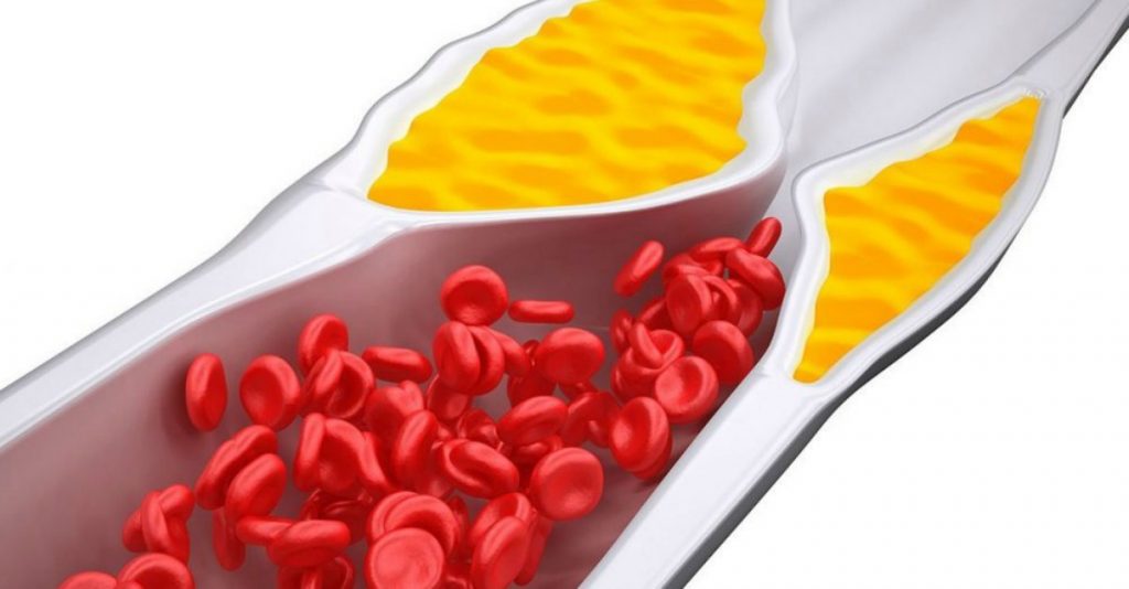 9 Alimentos Para Limpiar Las Arterias Y Venas